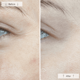 Omnilux Contour Face Mask