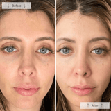 Omnilux Contour Face Mask