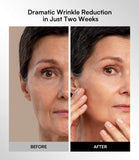 Inia Red & Infrared LED Therapy for the Face
