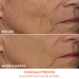 Dr Dennis Gross DRx SpectraLite DPL FaceWare Pro