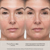 TheraFace PRO Microcurrent Facial Device