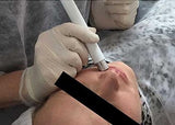 SkinCooler Pen