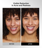 Inia Red & Infrared LED Therapy for the Face