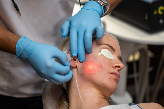 Person receiving LASEMAR treatment on the face 