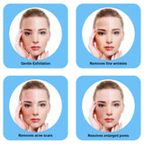 Image showing 4 benefits of Microdermabrasion devices. It is an ideal device purchase. 